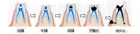 补牙