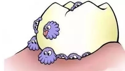 龋齿